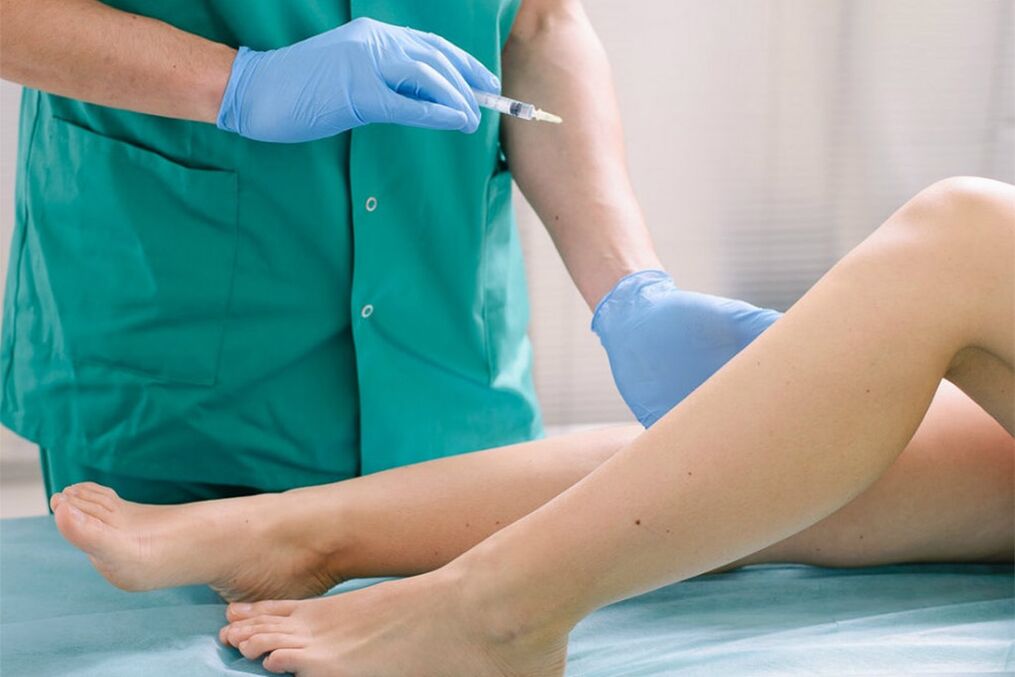 scleroterapie pentru îndepărtarea venelor varicoase